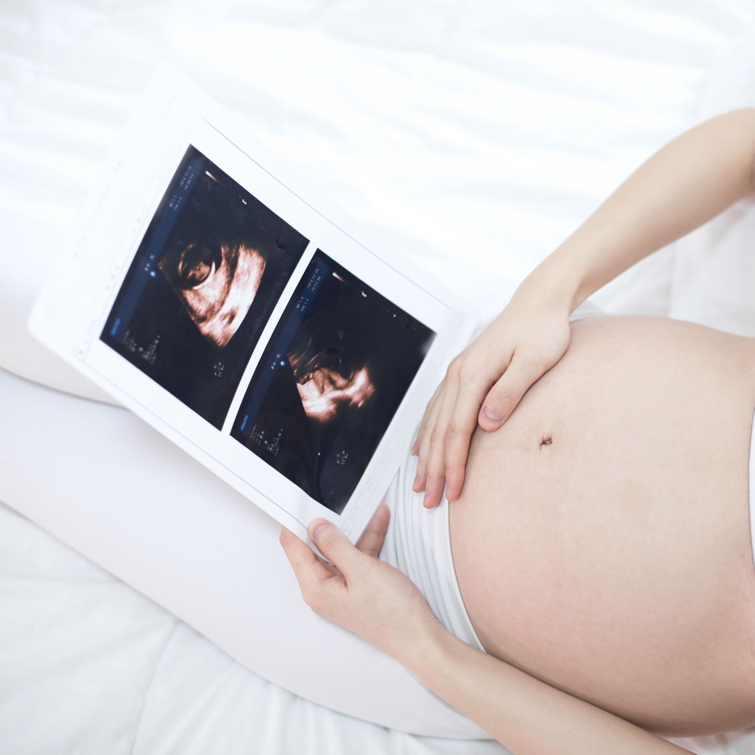 Mamans de jumeaux : elles racontent le jour de l'annonce !